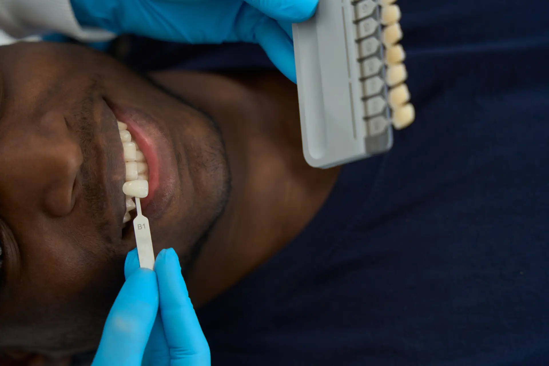Cosmetic Dental Treatments
