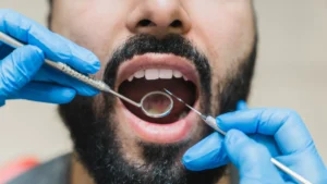 Root Canal specialist