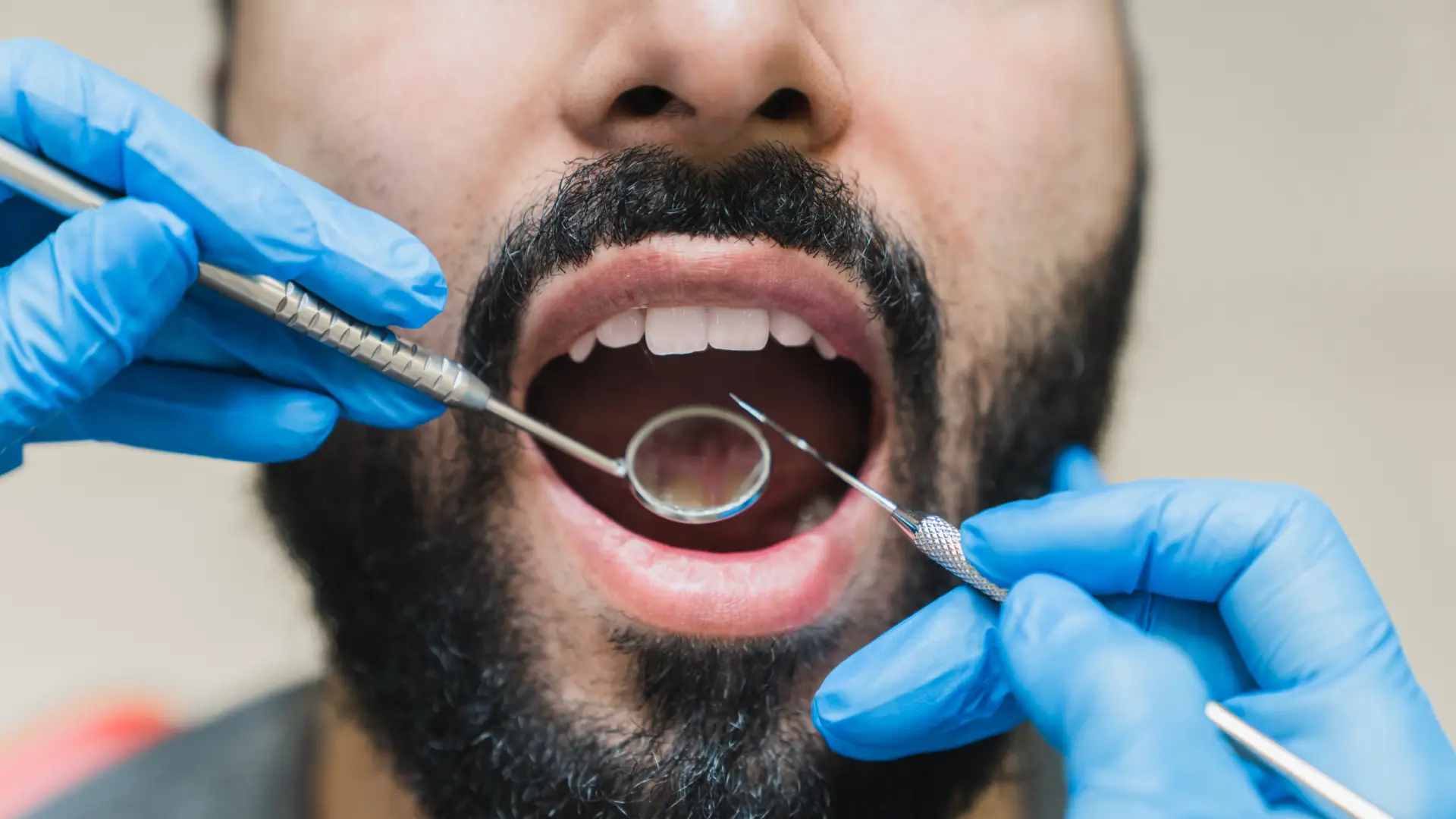Root Canal specialist
