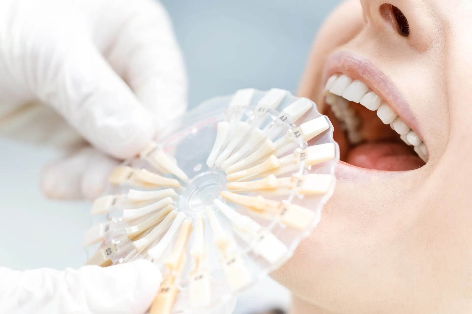 Whitening