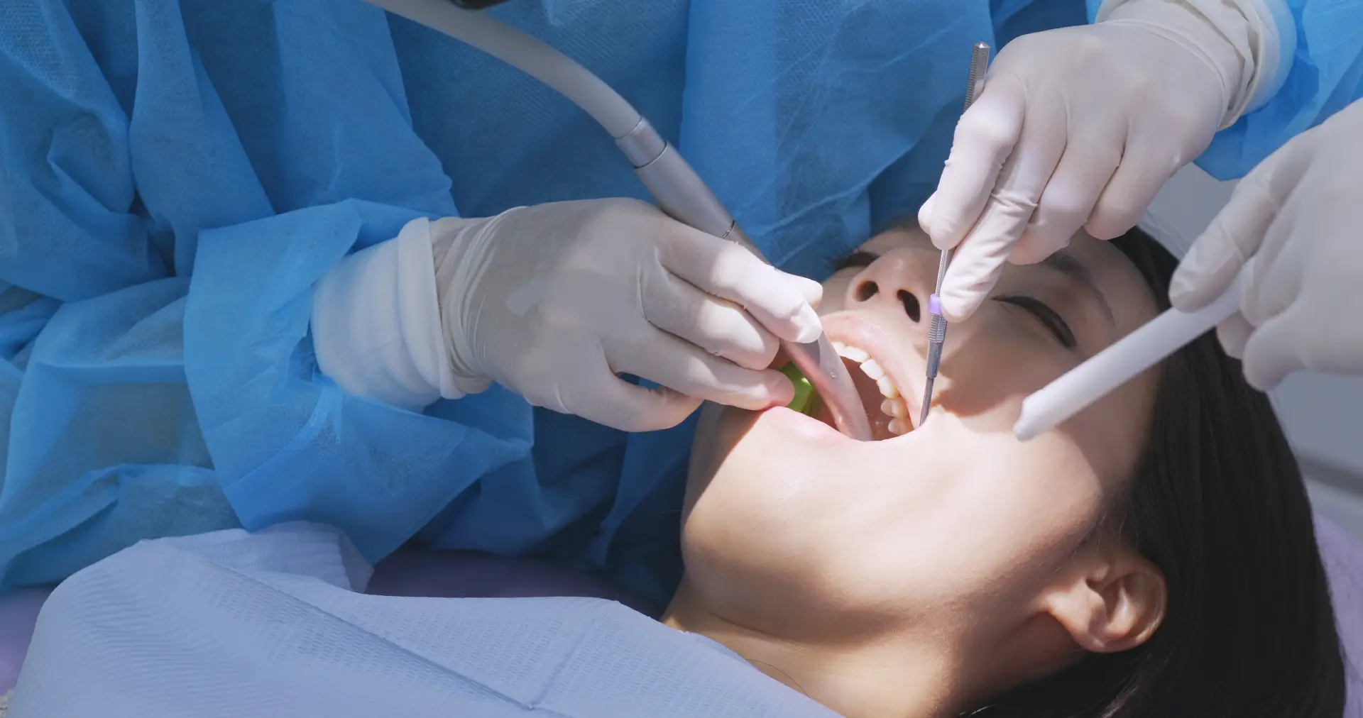 Wisdom Tooth Extractions